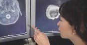 Neurology Neurology